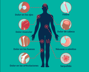 Síntomas dengue