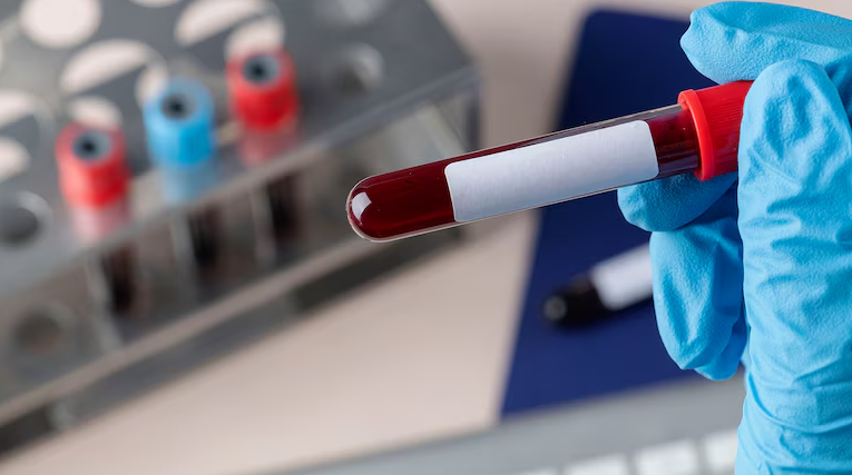 Sangre Artificial Universal