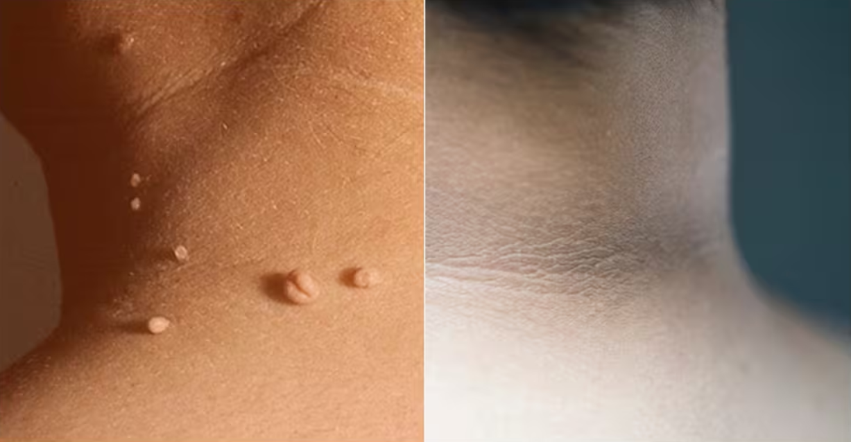 Otros Posibles Síntomas Cutáneos a Considerar