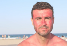 ¿Cómo quitar lo quemado por el sol rápido remedios caseros? ¿Cómo quitar lo quemado por el sol rápido remedios caseros?