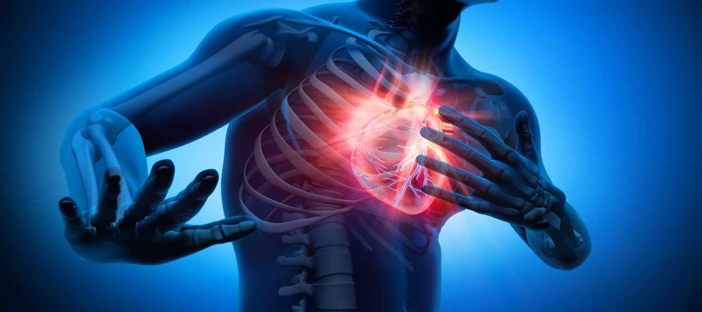 Las señales de alerta de un infarto: más allá del pecho