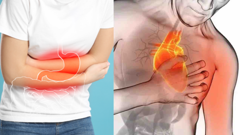 ¿Dolor de estómago o problema al corazón? Cómo diferenciar los síntomas de la gastritis de un posible infarto